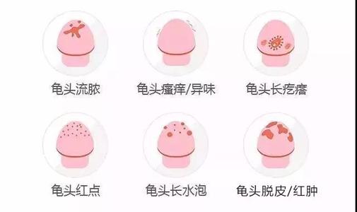包皮龟头炎症怎么治疗,包皮龟头炎治疗方法,龟头包茎发炎怎么办